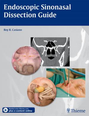 Cover of the book Endoscopic Sinonasal Dissection Guide by Sylvia H. Heywang-Koebrunner, Ingrid Schreer, Susan Barter