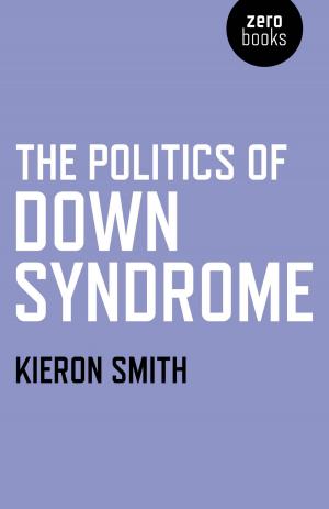 Cover of the book The Politics of Down Syndrome by Siusaidh Ceanadach