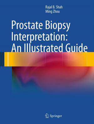 Cover of the book Prostate Biopsy Interpretation: An Illustrated Guide by Xiaofeng Meng, Zhiming Ding, Jiajie Xu