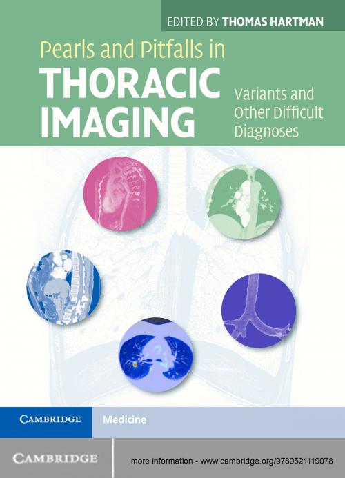 Cover of the book Pearls and Pitfalls in Thoracic Imaging by , Cambridge University Press