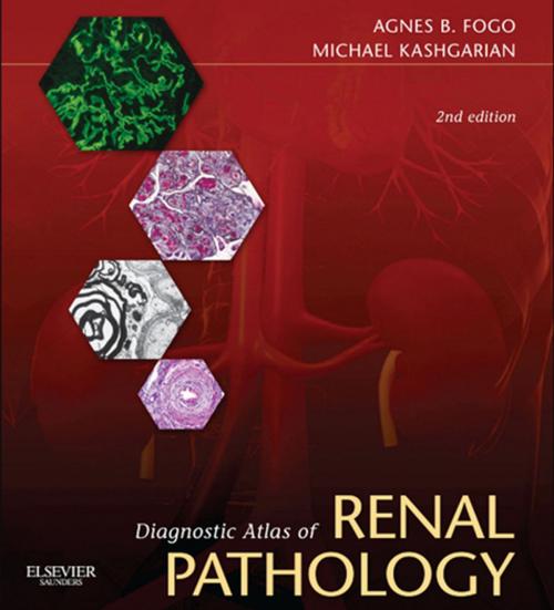 Cover of the book Diagnostic Atlas of Renal Pathology E-Book by Agnes B. Fogo, MD, Michael Kashgarian, MD, Elsevier Health Sciences
