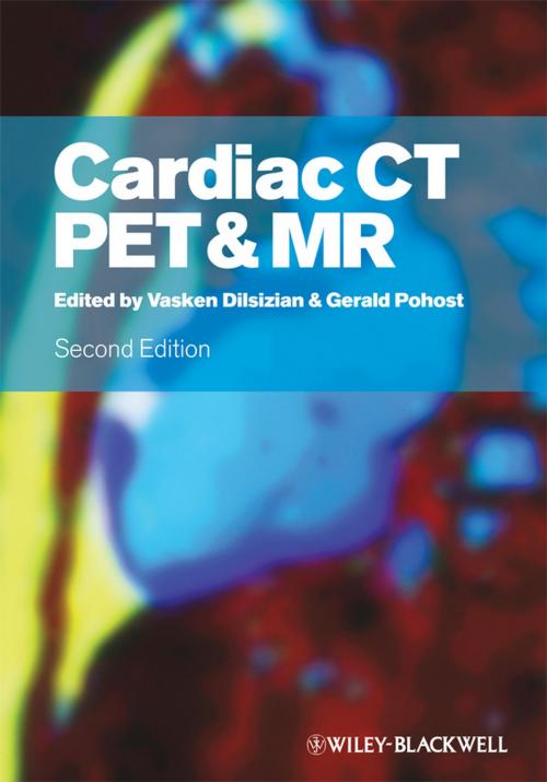 Cover of the book Cardiac CT, PET and MR by , Wiley