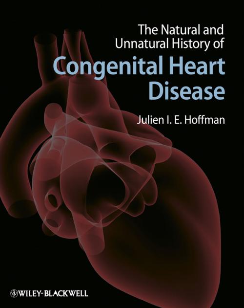 Cover of the book The Natural and Unnatural History of Congenital Heart Disease by , Wiley