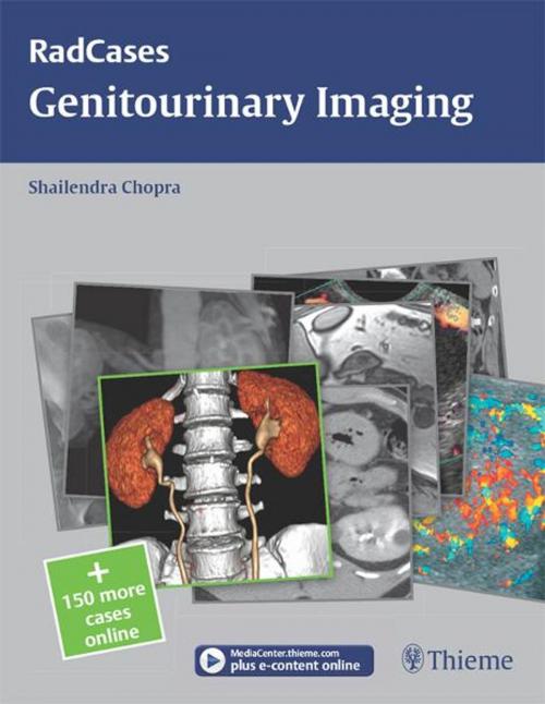Cover of the book Genitourinary Imaging by Shailendra Chopra, Thieme
