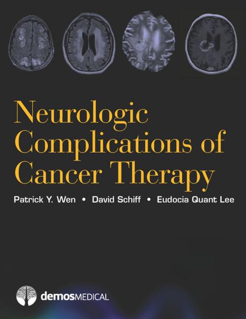 Cover of the book Neurologic Complications of Cancer Therapy by Eudocia Quant Lee, MD, MPH, David Schiff, MD, Patrick Y. Wen, MD, Springer Publishing Company