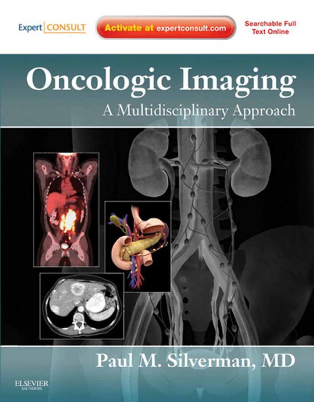 Big bigCover of Oncologic Imaging: A Multidisciplinary Approach E-Book
