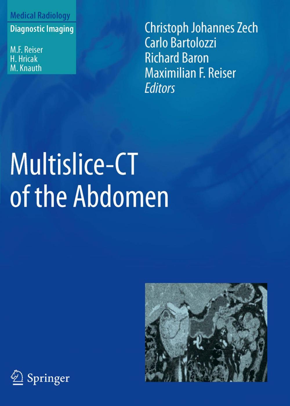Big bigCover of Multislice-CT of the Abdomen