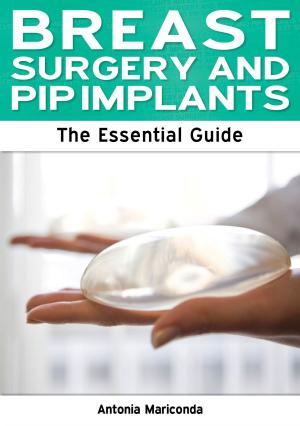 Cover of the book Breast Surgery and PIP Implants: The Essential Guide by Julie Campbell