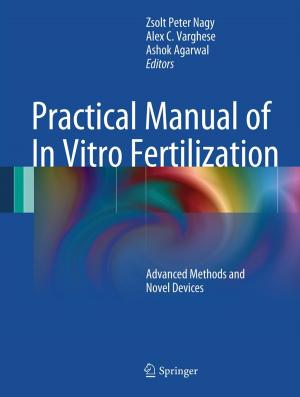 Cover of the book Practical Manual of In Vitro Fertilization by Jeffrey A. Dubin