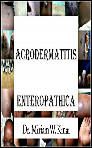 Book cover of Acrodermatitis Enteropathica
