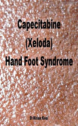 Book cover of Capecitabine (Xeloda) Hand Foot Syndrome