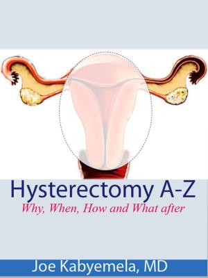Book cover of Hysterectomy A-Z: Why, When, How and What after