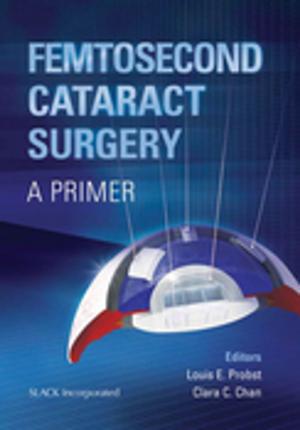 bigCover of the book Femtosecond Cataract Surgery by 