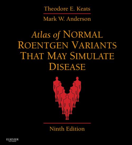 Cover of the book Atlas of Normal Roentgen Variants That May Simulate Disease by Theodore E. Keats, Mark W. Anderson, Elsevier Health Sciences