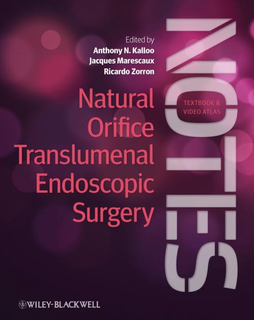 Cover of the book Natural Orifice Translumenal Endoscopic Surgery (NOTES) by , Wiley