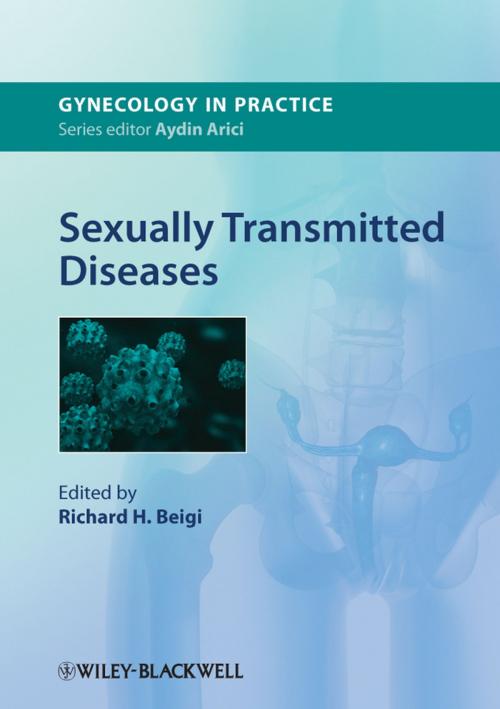 Cover of the book Sexually Transmitted Diseases by , Wiley