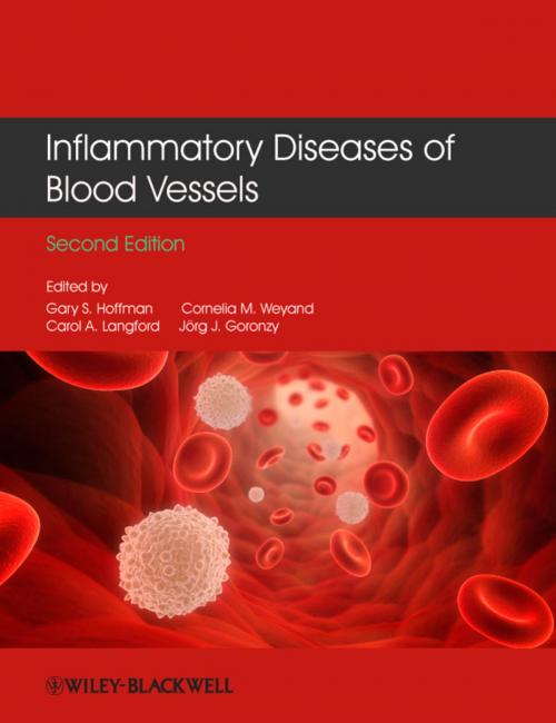 Cover of the book Inflammatory Diseases of Blood Vessels by , Wiley