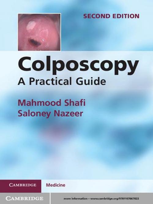 Cover of the book Colposcopy by Mahmood Shafi, Saloney Nazeer, Cambridge University Press