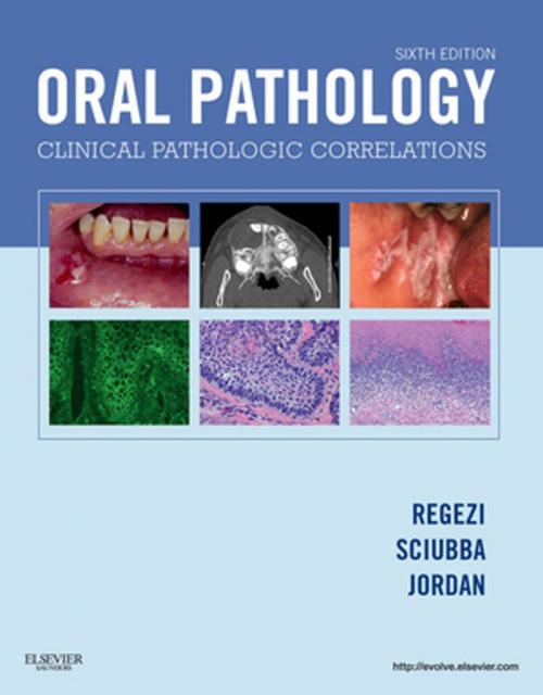 Cover of the book Oral Pathology - E-Book by Joseph A. Regezi, DDS, MS, Richard C. K. Jordan, DDS, MSc, PhD, FRCD(C), FRCPATH, James Sciubba, DMD, PhD, Elsevier Health Sciences