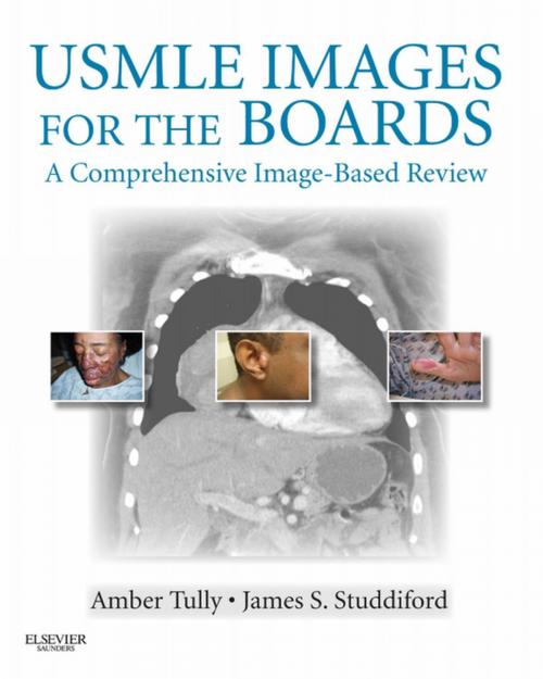 Cover of the book USMLE Images for the Boards E-Book by Amber S. Tully, MD, James S. Studdiford, MD, FACP, Elsevier Health Sciences