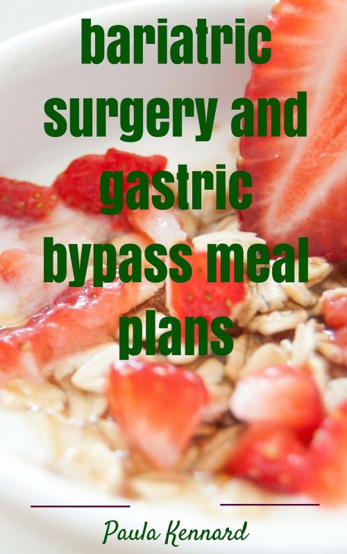 Cover of the book Bariatric Surgery and Gastric Bypass Meal Plans by Paula Kennard, AP Publishing
