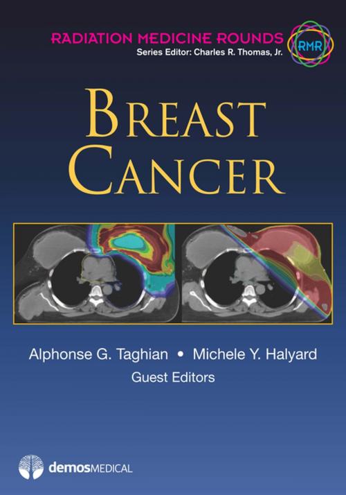 Cover of the book Breast Cancer by Michele Y. Halyard, Alphonse G. Taghian, MD, PhD, Charles R. Thomas, MD, Springer Publishing Company