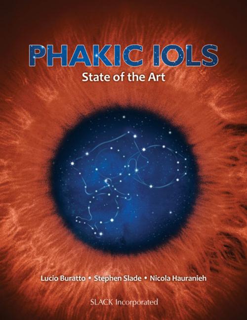 Cover of the book Phakic IOLs by , SLACK Incorporated