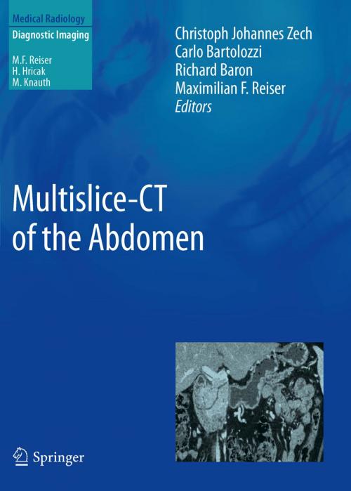 Cover of the book Multislice-CT of the Abdomen by , Springer Berlin Heidelberg