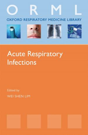 Cover of the book Acute Respiratory Infections by Stanley Wells