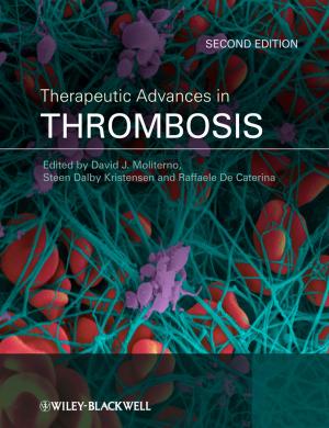 bigCover of the book Therapeutic Advances in Thrombosis by 