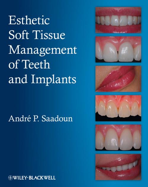 Cover of the book Esthetic Soft Tissue Management of Teeth and Implants by Andre P. Saadoun, Wiley