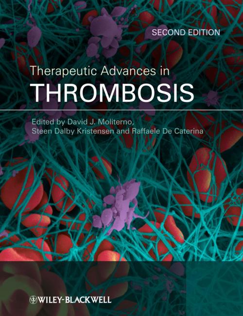 Cover of the book Therapeutic Advances in Thrombosis by , Wiley
