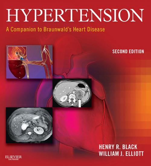 Cover of the book Hypertension: A Companion to Braunwald's Heart Disease E-Book by William Elliott, MD, PhD, Henry R. Black, MD, Elsevier Health Sciences