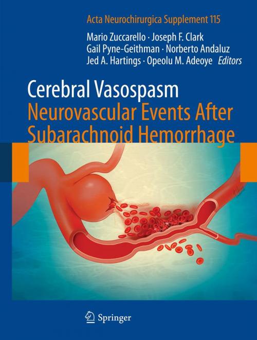 Cover of the book Cerebral Vasospasm: Neurovascular Events After Subarachnoid Hemorrhage by , Springer Vienna