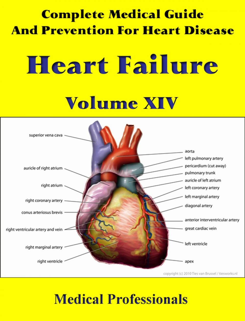 Big bigCover of Complete Medical Guide and Prevention for Heart Diseases Volume XIV; Heart Failure