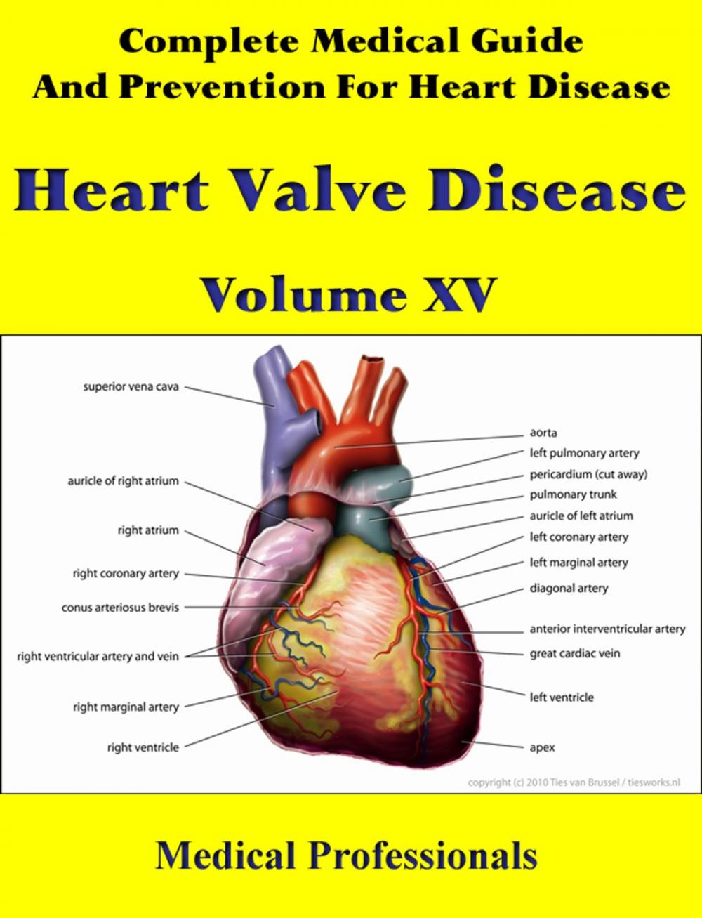 Big bigCover of Complete Medical Guide and Prevention for Heart Diseases Volume XV; Heart Valve Disease