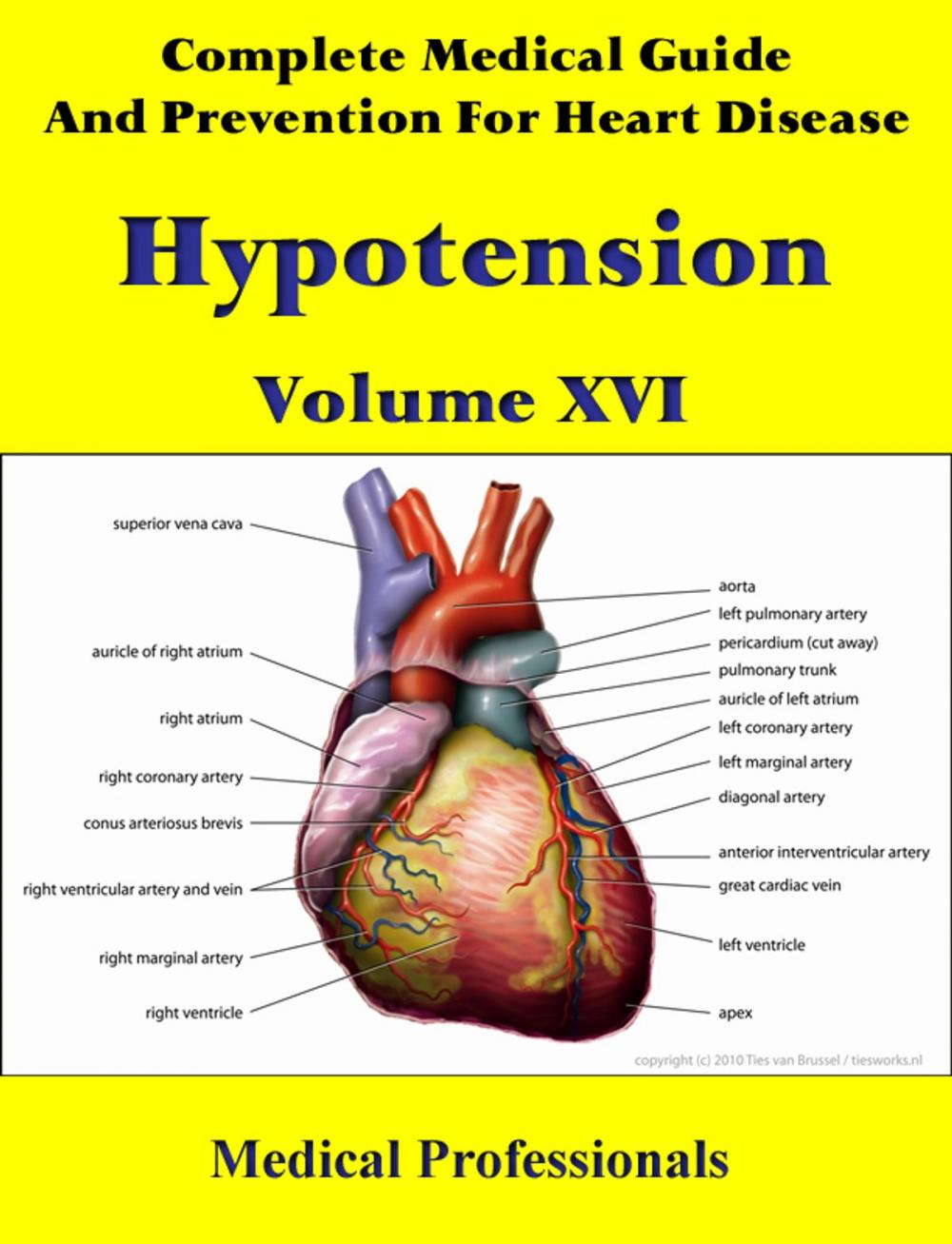 Big bigCover of A Complete Medical Guide and Prevention For Heart Diseases Volume XVI; Hypotension
