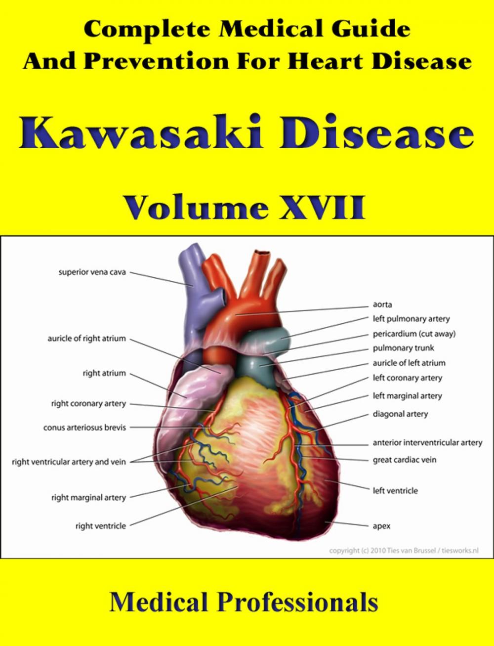Big bigCover of A Complete Medical Guide and Prevention For Heart Diseases Volume XVII; Kawasaki Disease