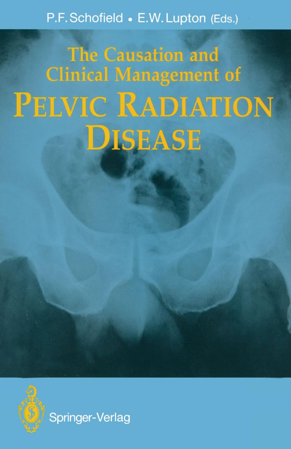Big bigCover of The Causation and Clinical Management of Pelvic Radiation Disease