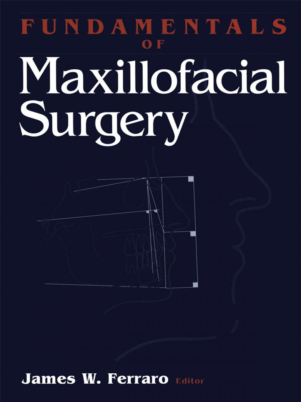 Big bigCover of Fundamentals of Maxillofacial Surgery
