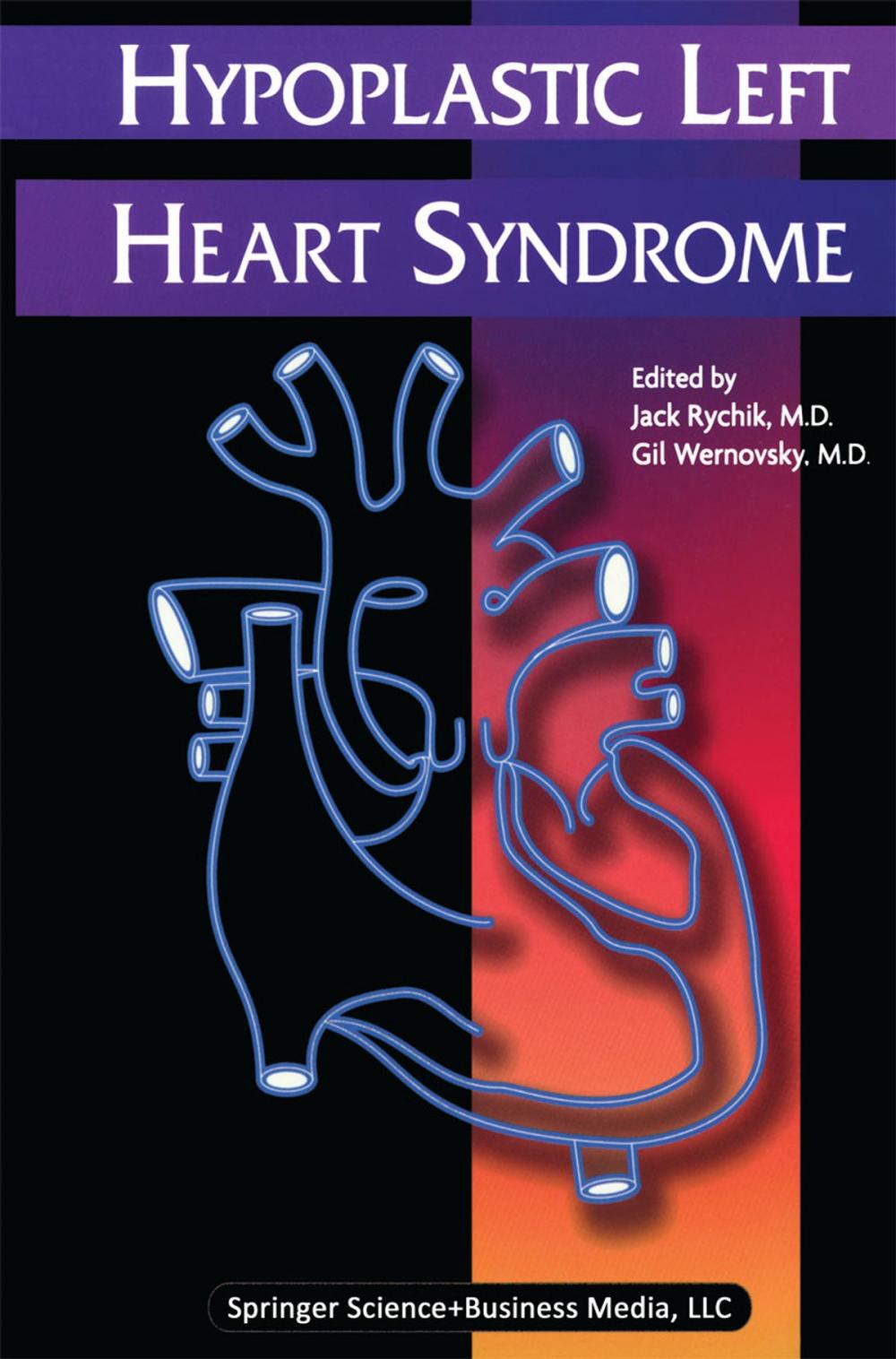 Big bigCover of Hypoplastic Left Heart Syndrome