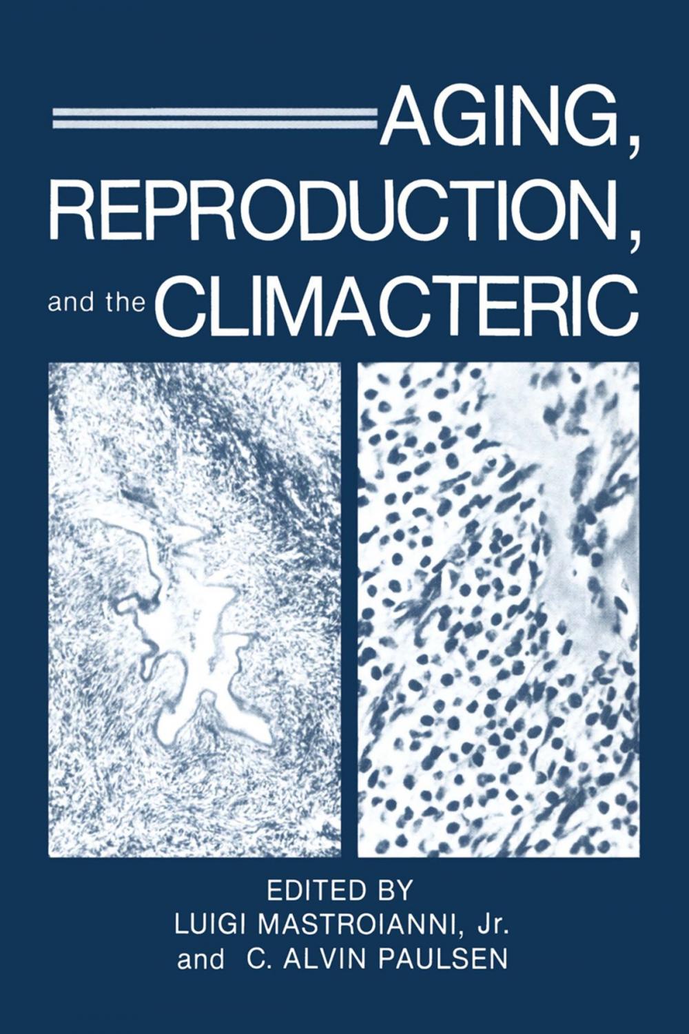 Big bigCover of Aging, Reproduction, and the Climacteric