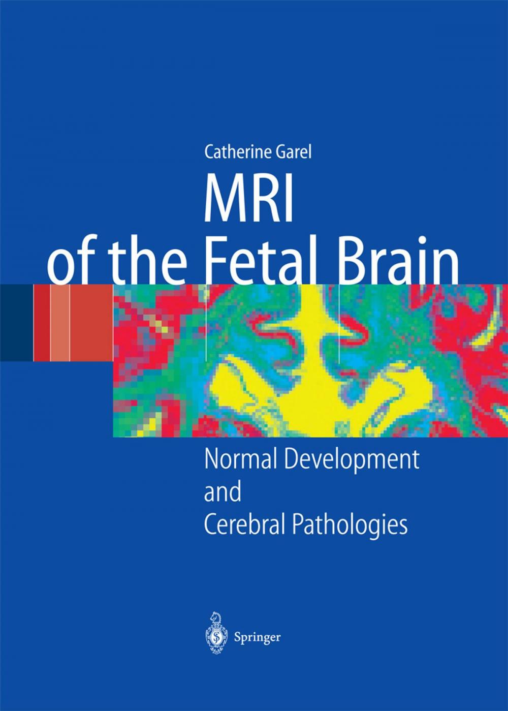 Big bigCover of MRI of the Fetal Brain