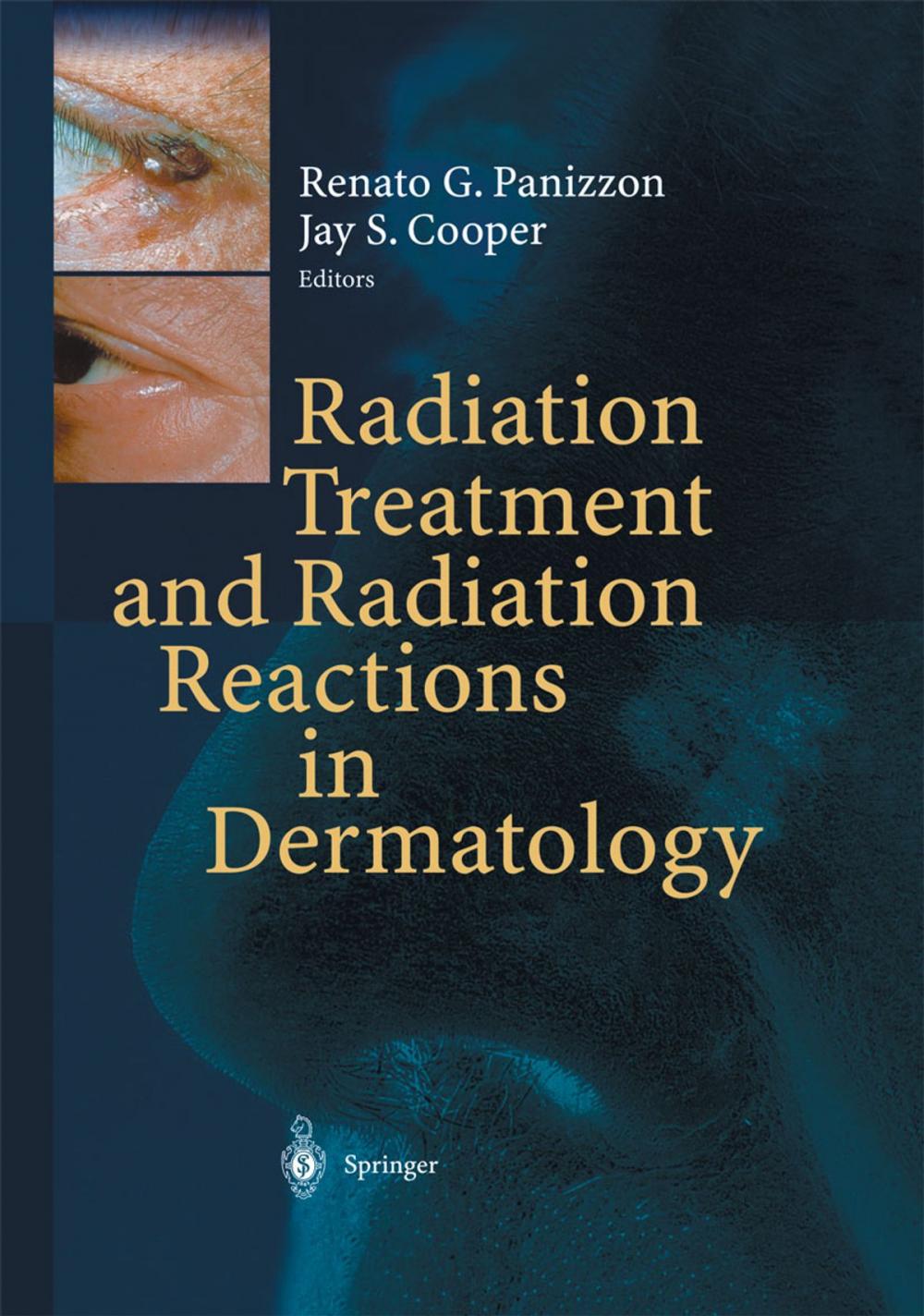 Big bigCover of Radiation Treatment and Radiation Reactions in Dermatology