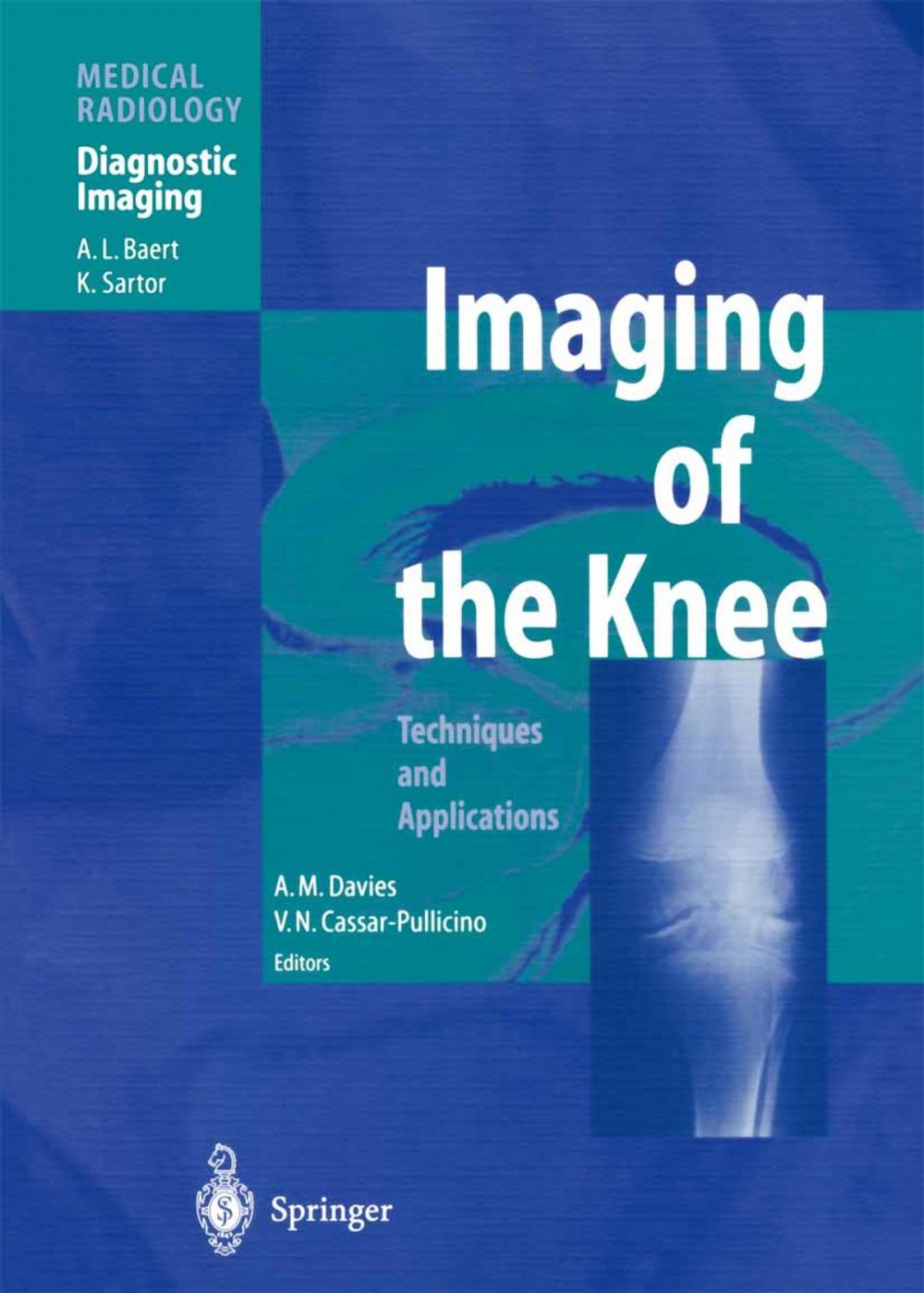 Big bigCover of Imaging of the Knee