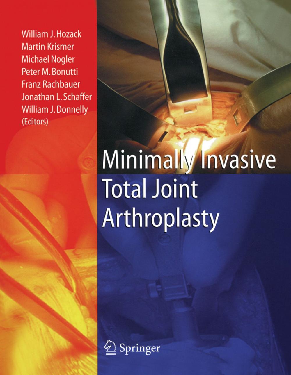 Big bigCover of Minimally Invasive Total Joint Arthroplasty
