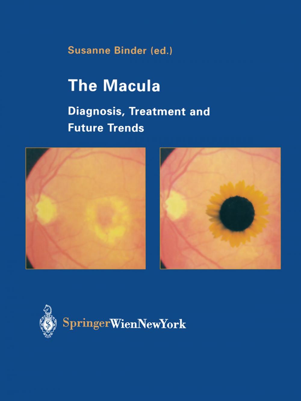 Big bigCover of The Macula