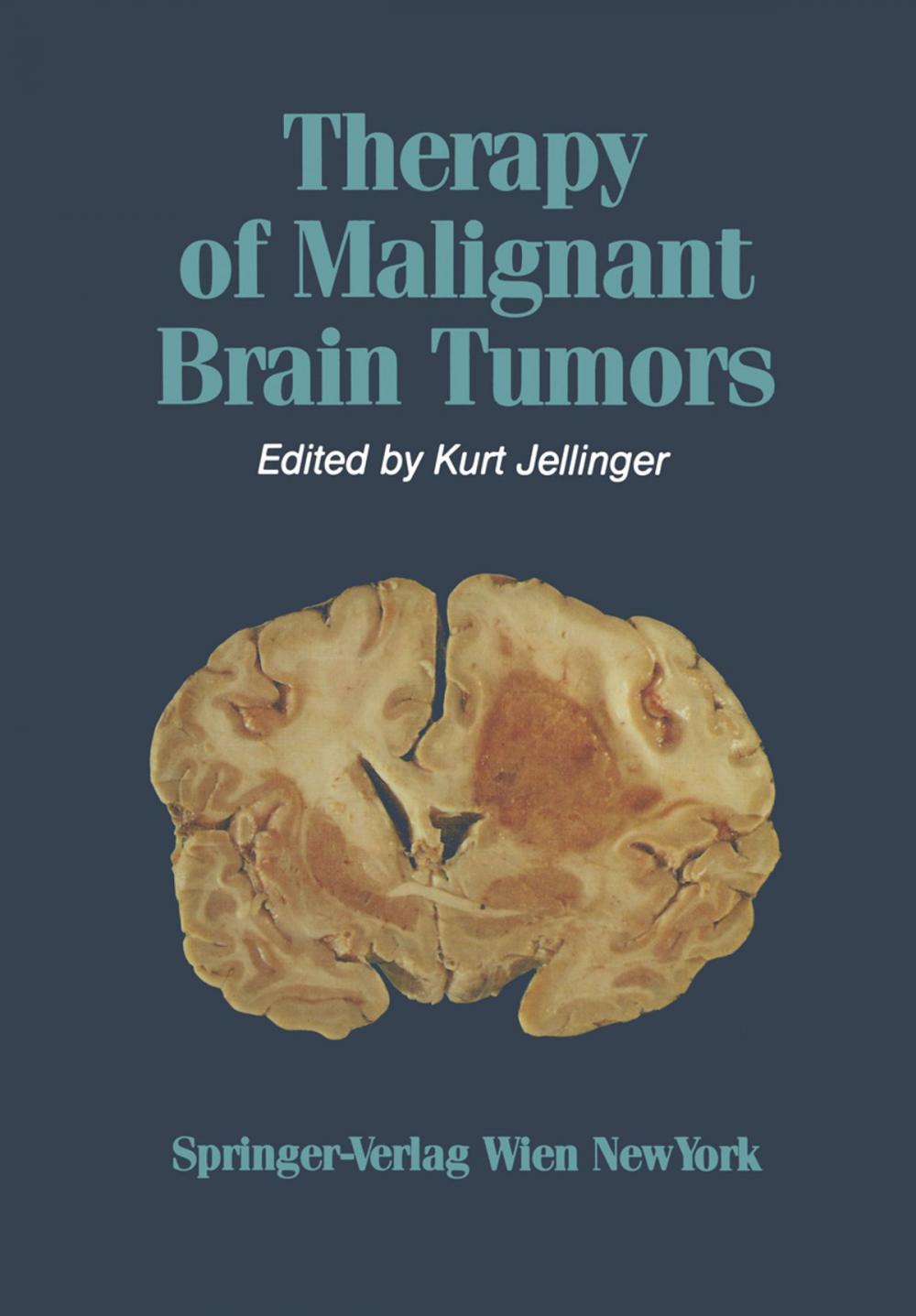 Big bigCover of Therapy of Malignant Brain Tumors