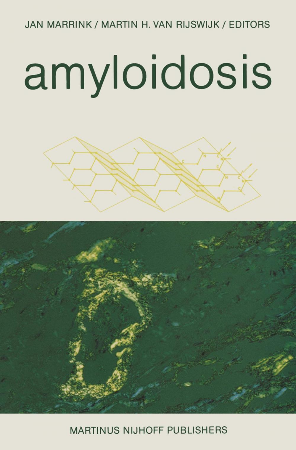 Big bigCover of Amyloidosis