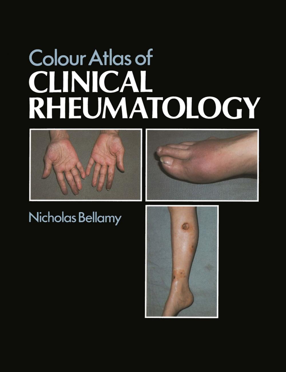 Big bigCover of Colour Atlas of Clinical Rheumatology